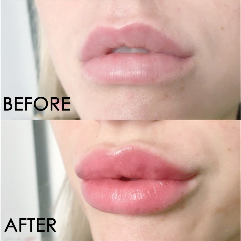 Lip Care Serum Instant Volumis - Lip Gloss Plumping ulasan dan harga